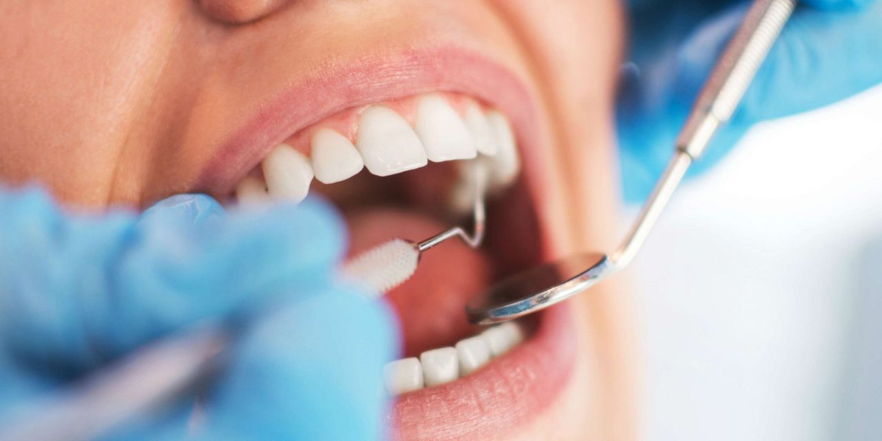 Sei falsi dentisti denunciati nel Napoletano per esercizio abusivo della professione: i comuni interessati