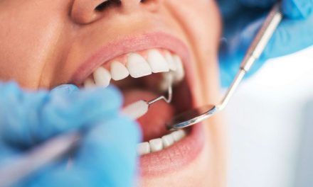 Sei falsi dentisti denunciati nel Napoletano per esercizio abusivo della professione: i comuni interessati